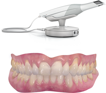 Scanner intraoral 3Shape Trios 3 com arcada escaneada em RealColor